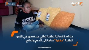 مناشدة إنسانية لطفلة تعاني من ضمور في النمو .. الطفلة "مغفرة "بحاجة إلى الدعم والعلاج