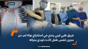 استخراج نواة بلح من طفل تسببت في اختناقه