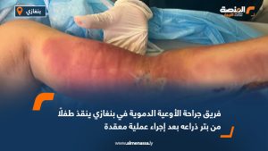 فريق جراحة الأوعية الدموية في بنغازي ينقذ طفلًا من بتر ذراعه بعد إجراء عملية معقدة