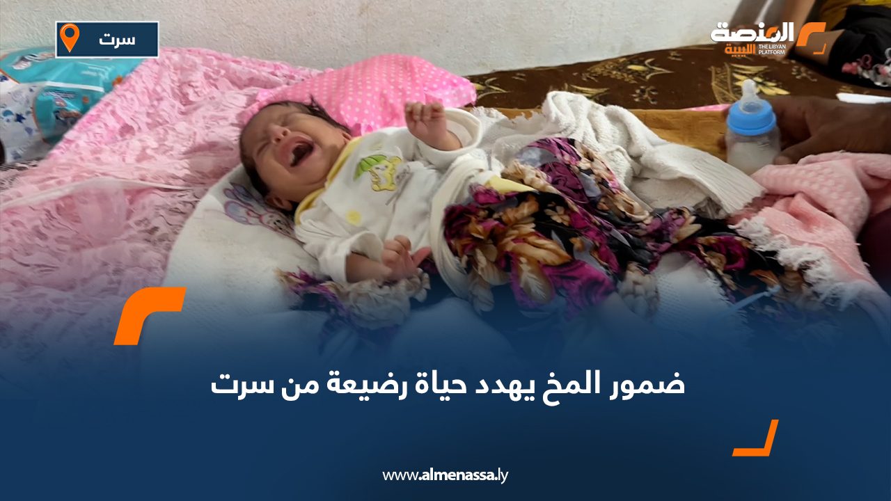 ضمور المخ يهدد حياة رضيعة من سرت