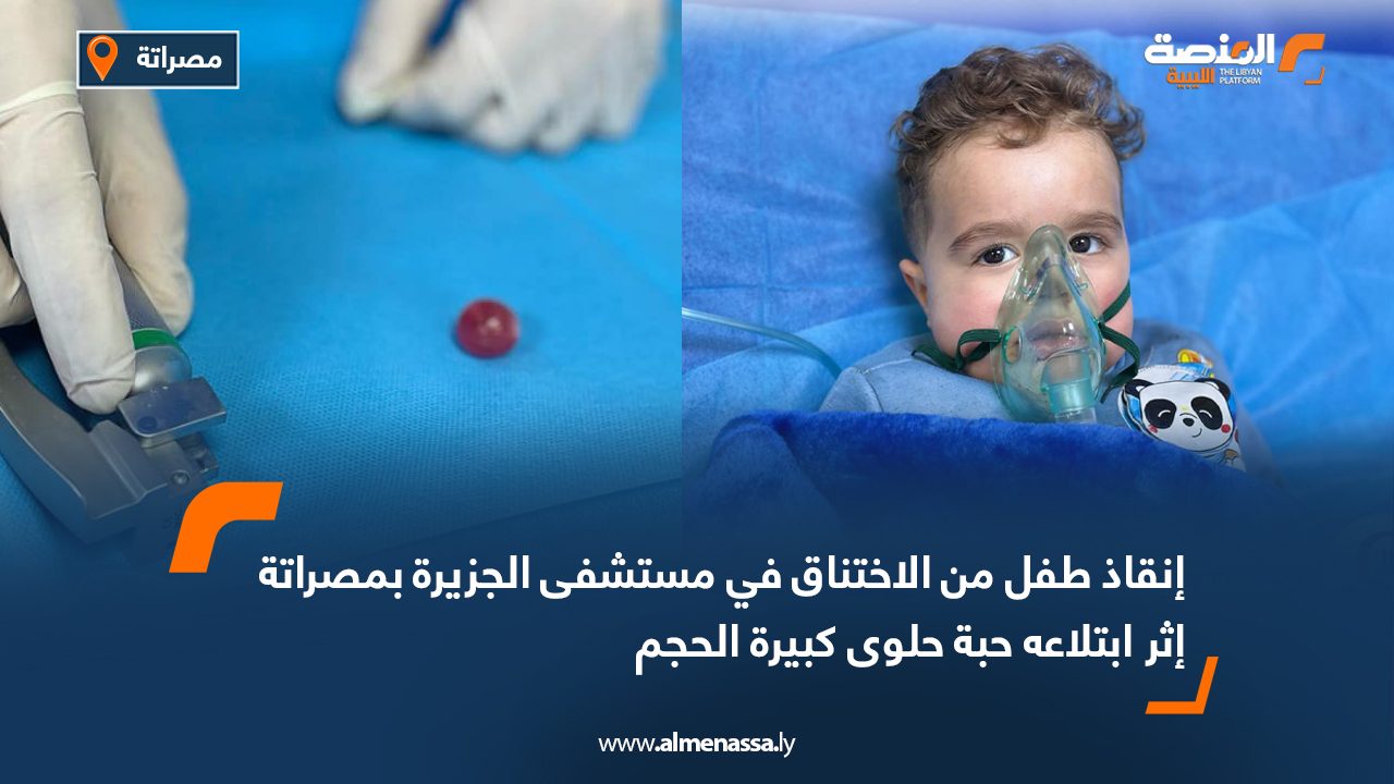 إنقاذ طفل من الاختناق في مستشفى الجزيرة بمصراتة إثر ابتلاعه حبة حلوى كبيرة الحجم