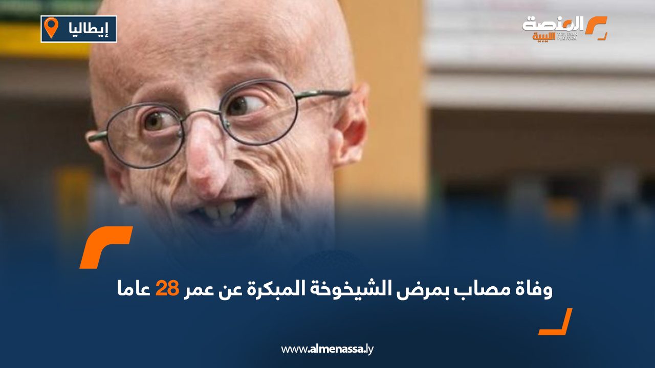 وفاة مصاب بمرض الشيخوخة المبكرة عن عمر 28 عاما