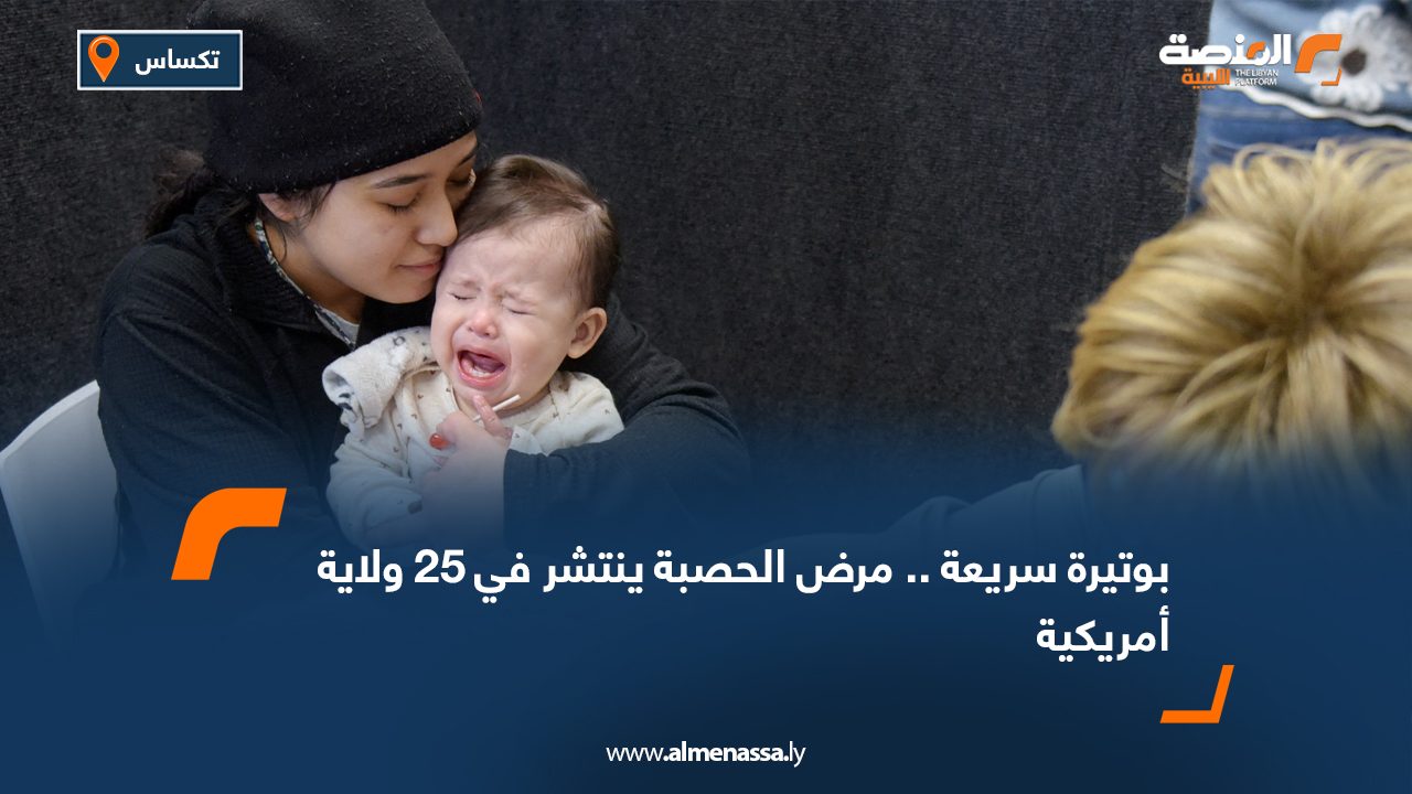بوتيرة سريعة.. مرض الحصبة ينتشر في 25 ولاية أمريكية
