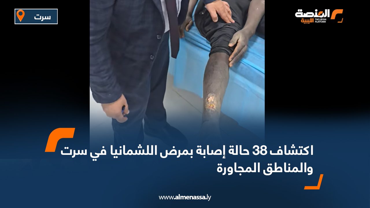 اكتشاف 38 حالة إصابة بمرض اللشمانيا في سرت والمناطق المجاورة