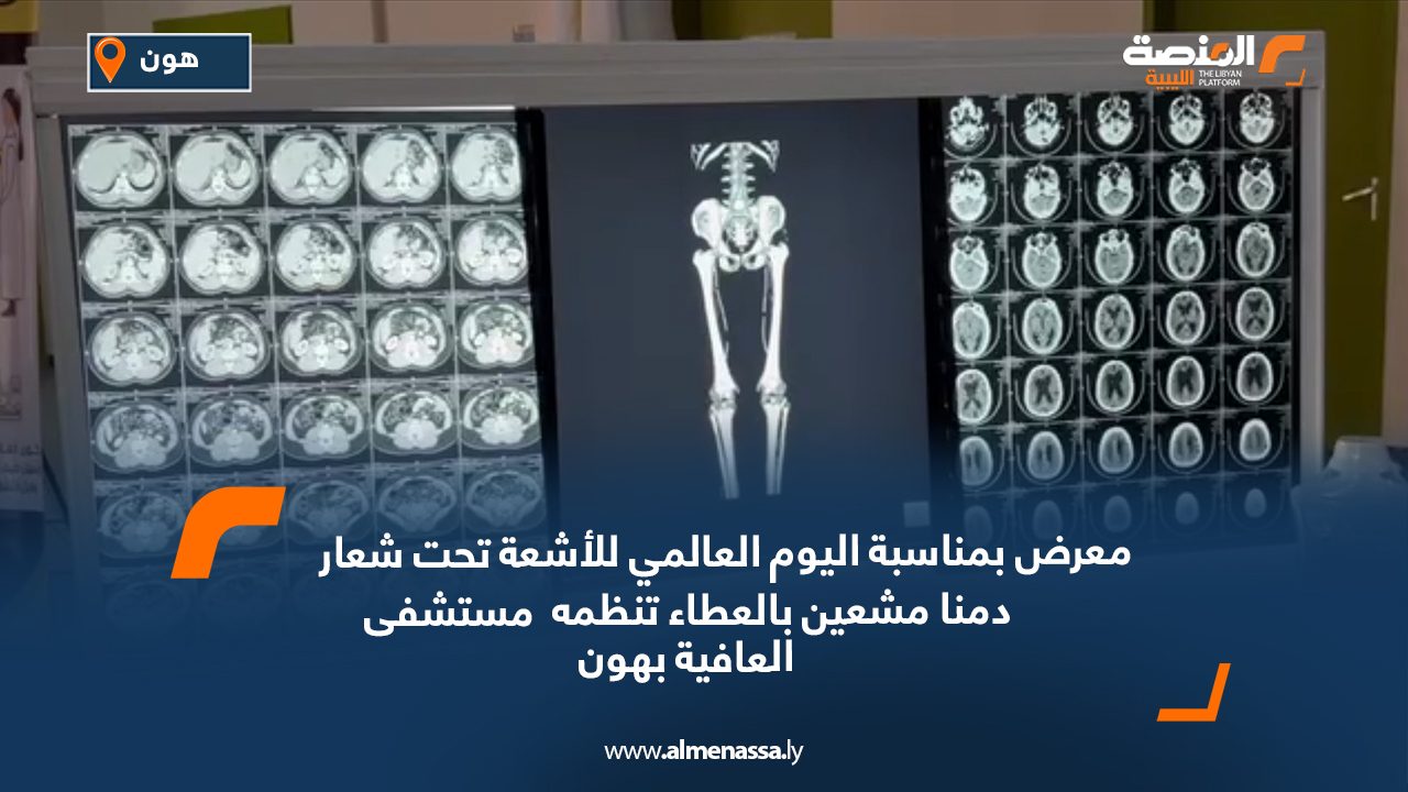 معرض بمناسبة اليوم العالمي للأشعة تحت شعار دمنا مشعين بالعطاء تنظمه مستشفى العافية بهون