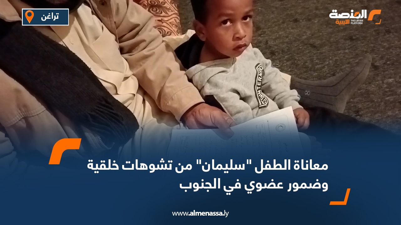 معاناة الطفل "سليمان" من تشوهات خلقية وضمور عضوي في الجنوب